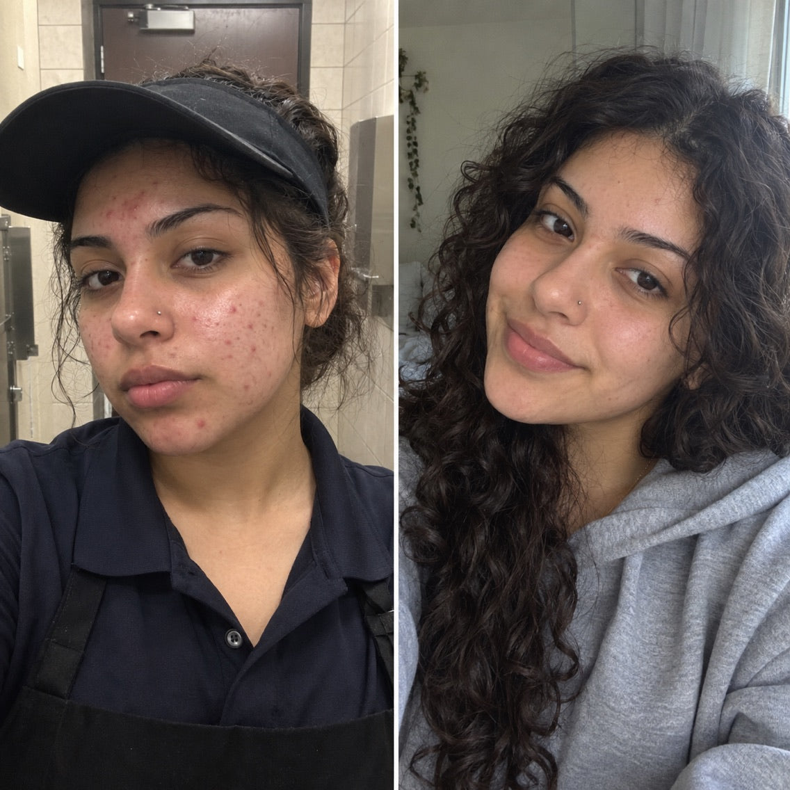 Example before and after selfies, customer 1