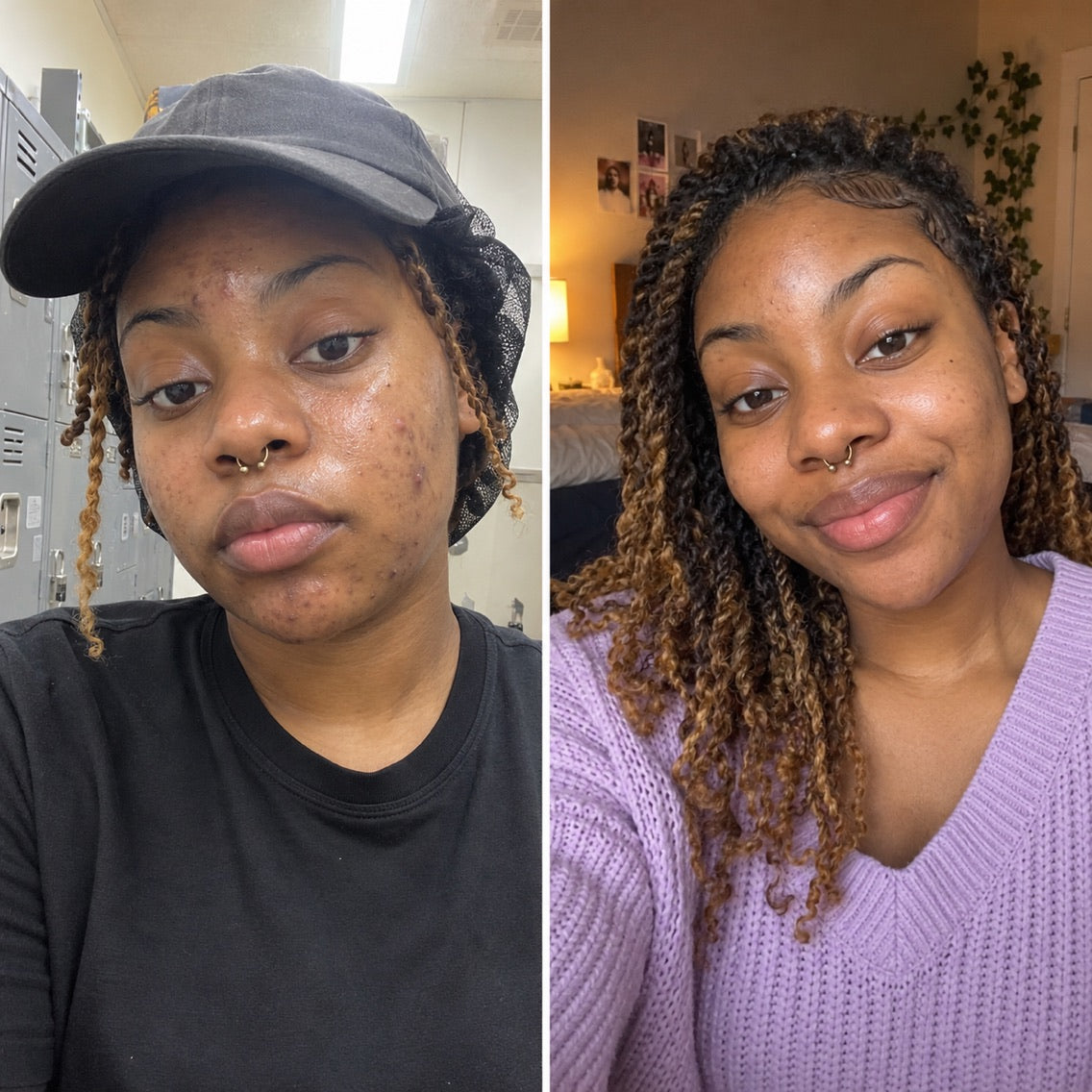 Example before and after selfies, customer 3