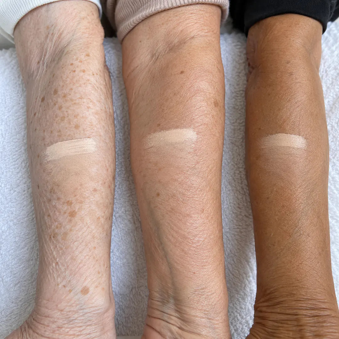 Three forearms, the white stripe turning into each skin tone