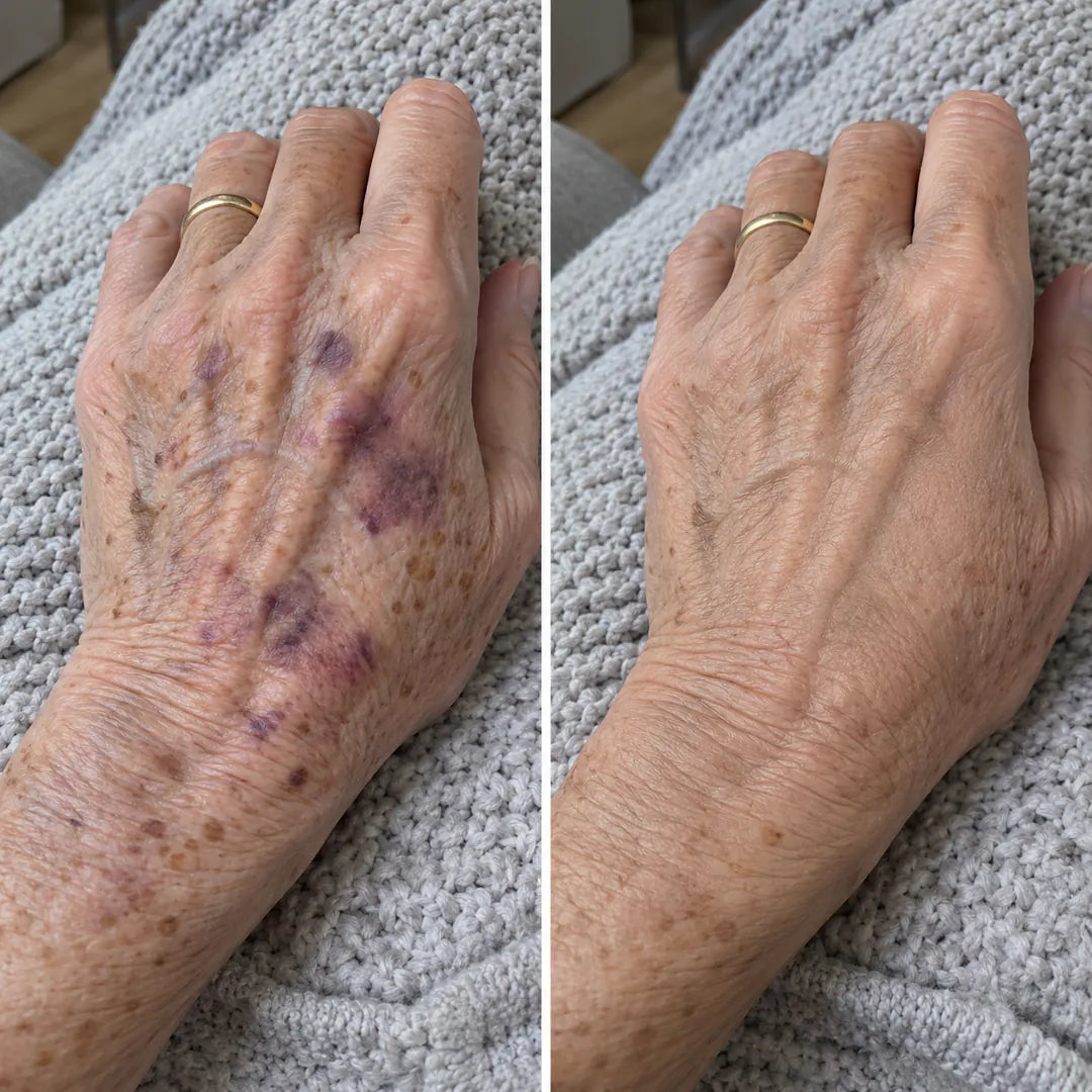 The backs of the hands before and after