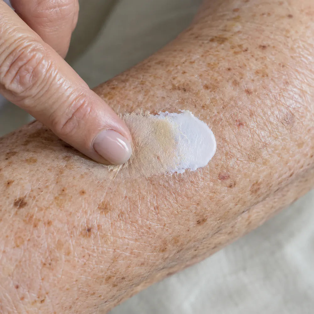 White cream blending into fair freckled skin