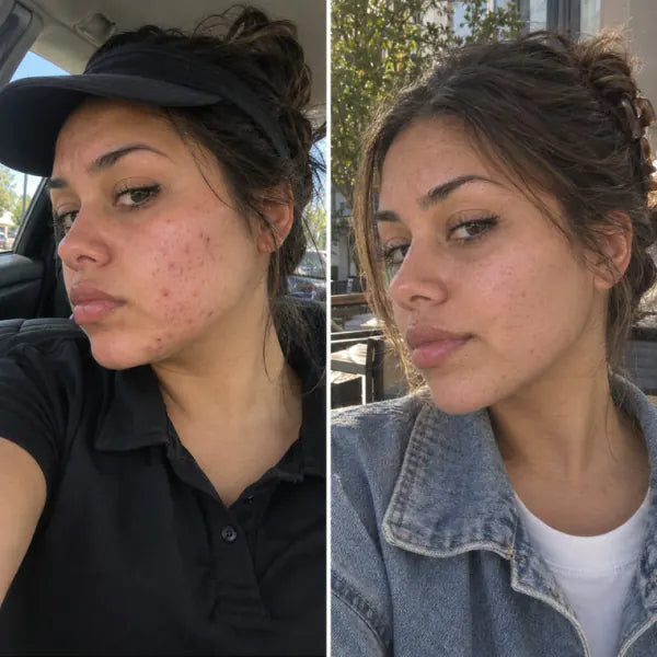 Maddie T. before and after, drive-thru
