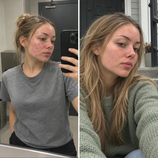 Kayla P. before and after, grill